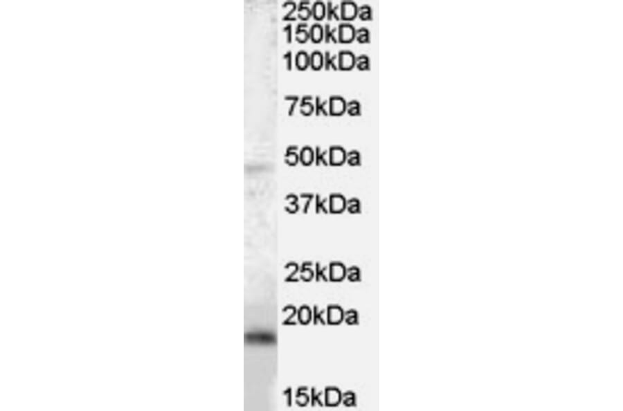 Western Blot - Anti-BAALC Antibody (A83225) - Antibodies.com