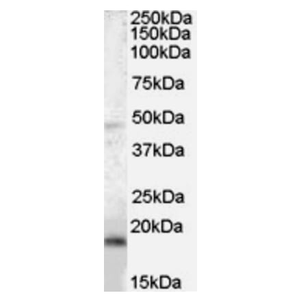 Western Blot - Anti-BAALC Antibody (A83225) - Antibodies.com