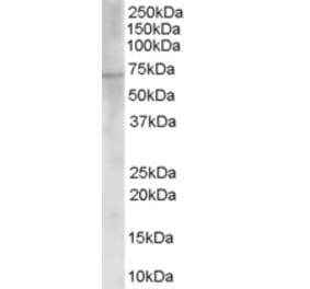 Western Blot - Anti-Choline Acetyltransferase Antibody (A83226) - Antibodies.com