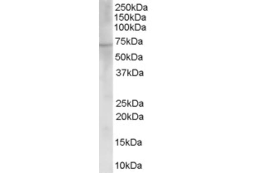 Western Blot - Anti-Choline Acetyltransferase Antibody (A83226) - Antibodies.com