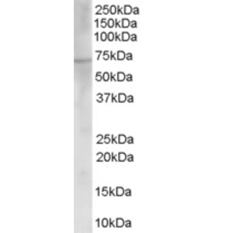 Western Blot - Anti-Choline Acetyltransferase Antibody (A83226) - Antibodies.com