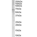 Western Blot - Anti-Choline Acetyltransferase Antibody (A83226) - Antibodies.com