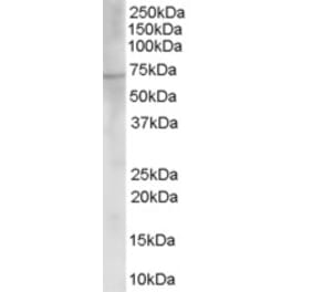 Western Blot - Anti-CHAT Antibody (A83226) - Antibodies.com