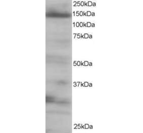 Western Blot - Anti-4E-T Antibody (A83228) - Antibodies.com