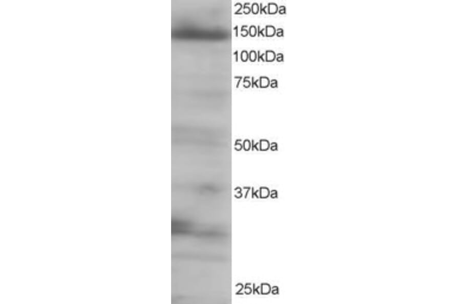Western Blot - Anti-4E-T Antibody (A83228) - Antibodies.com
