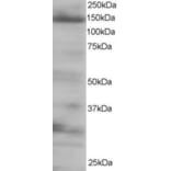 Western Blot - Anti-4E-T Antibody (A83228) - Antibodies.com
