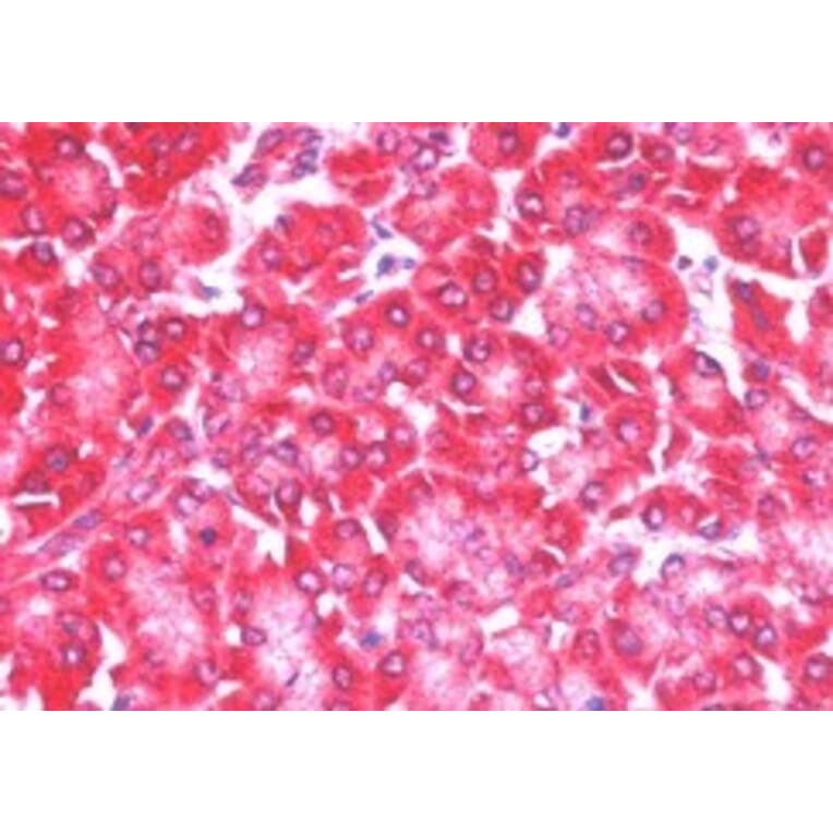 Immunohistochemistry - Anti-4E-T Antibody (A83228) - Antibodies.com