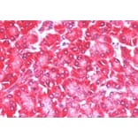 Immunohistochemistry - Anti-4E-T Antibody (A83228) - Antibodies.com