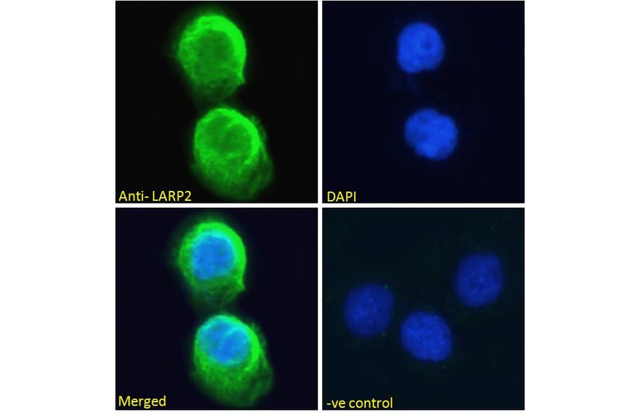 Immunofluorescence - Anti-LARP1B Antibody (A83229) - Antibodies.com
