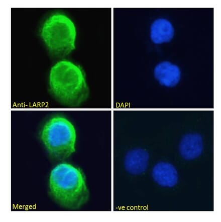Immunofluorescence - Anti-LARP1B Antibody (A83229) - Antibodies.com