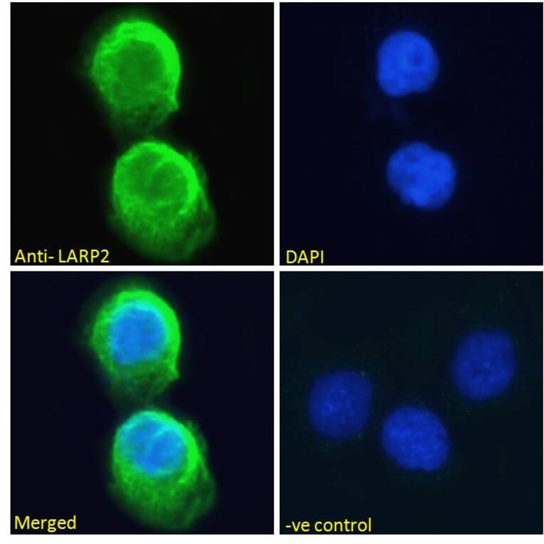 Immunofluorescence - Anti-LARP1B Antibody (A83229) - Antibodies.com