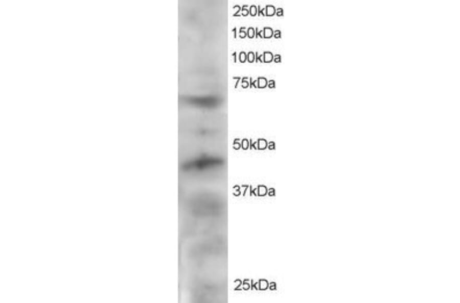 Western Blot - Anti-TRF1 Antibody (A83230) - Antibodies.com