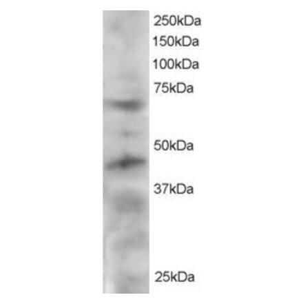 Western Blot - Anti-TRF1 Antibody (A83230) - Antibodies.com