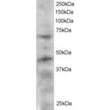Western Blot - Anti-TRF1 Antibody (A83230) - Antibodies.com