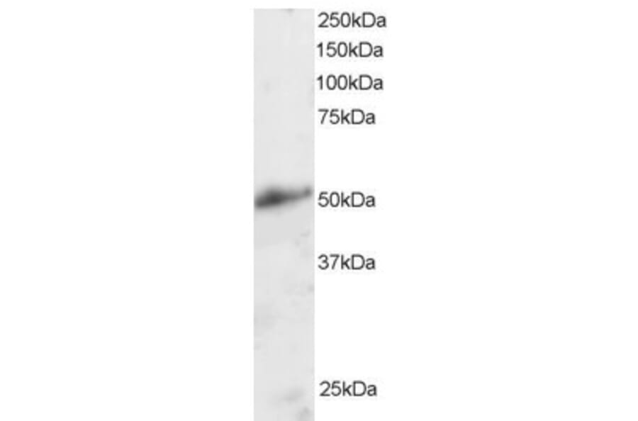 Western Blot - Anti-KLF8 Antibody (A83233) - Antibodies.com