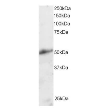 Western Blot - Anti-KLF8 Antibody (A83233) - Antibodies.com