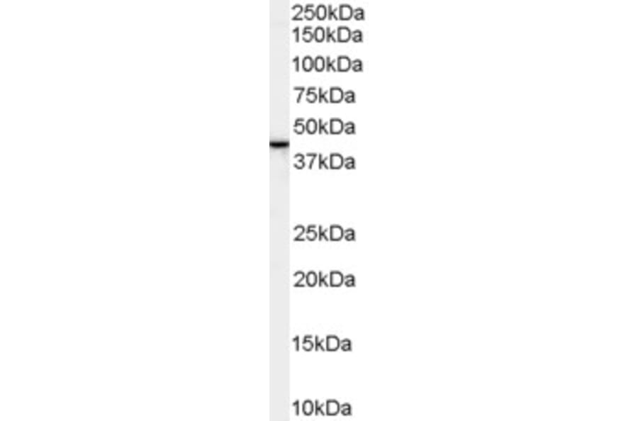 Western Blot - Anti-Erlin-2 Antibody (A83234) - Antibodies.com