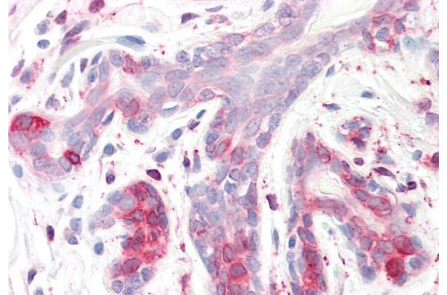 Immunohistochemistry - Anti-Erlin-2 Antibody (A83234) - Antibodies.com