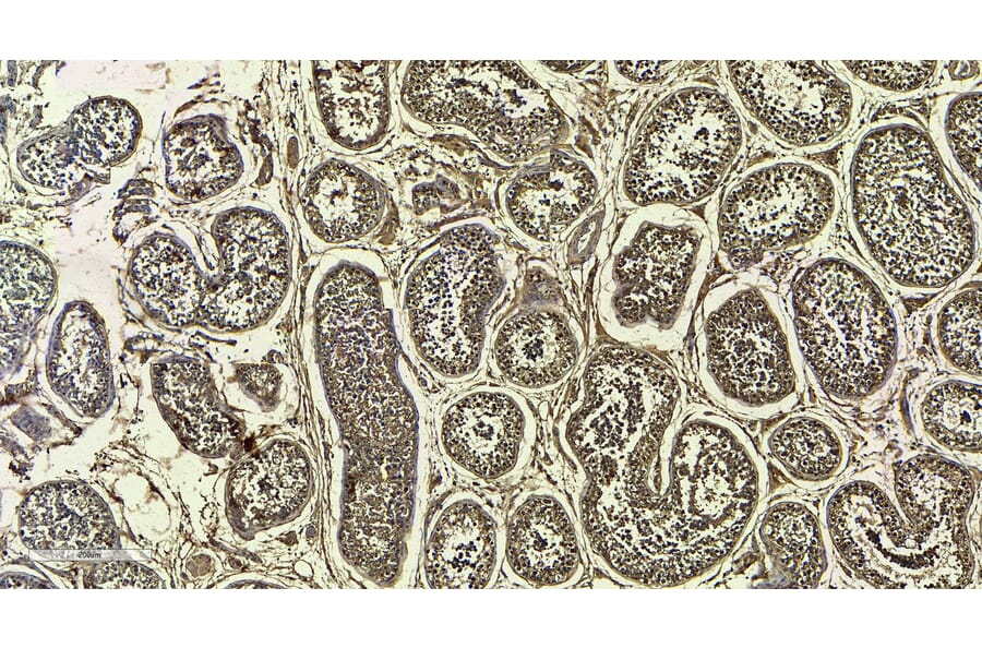 Immunohistochemistry - Anti-MRG15 Antibody (A83235) - Antibodies.com