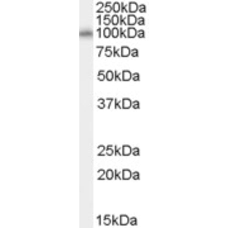 Western Blot - Anti-HEF1/NEDD-9 Antibody (A83238) - Antibodies.com