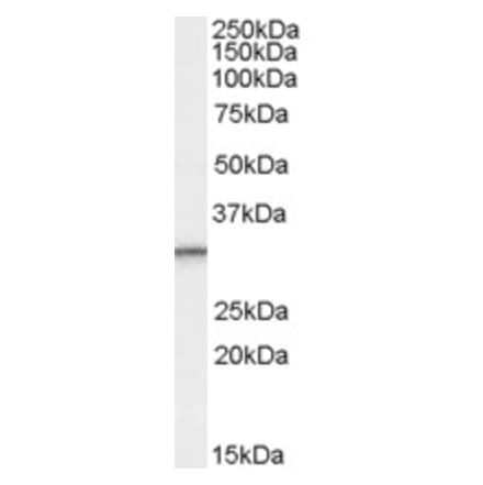 Western Blot - Anti-PSME1 Antibody (A83240) - Antibodies.com