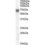 Western Blot - Anti-LPO Antibody (A83242) - Antibodies.com