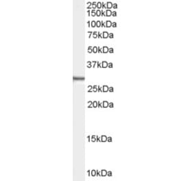 Western Blot - Anti-Syntenin Antibody (A83243) - Antibodies.com