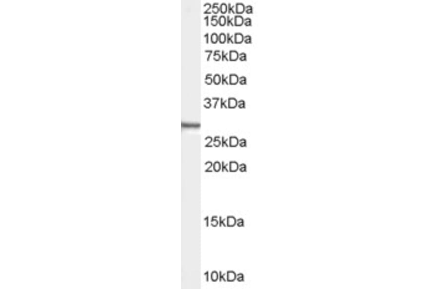 Western Blot - Anti-Syntenin Antibody (A83243) - Antibodies.com