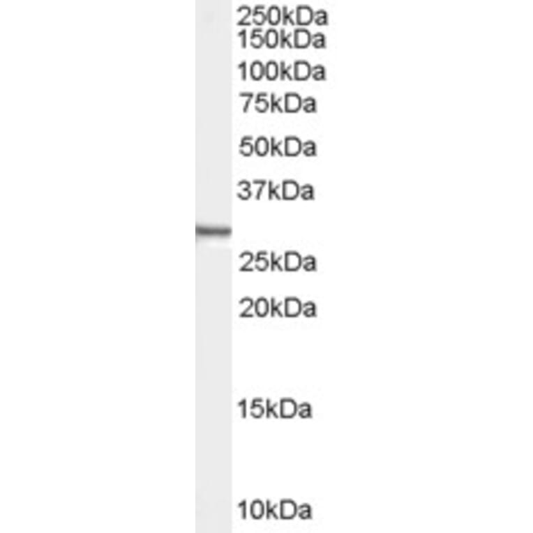 Western Blot - Anti-Syntenin Antibody (A83243) - Antibodies.com