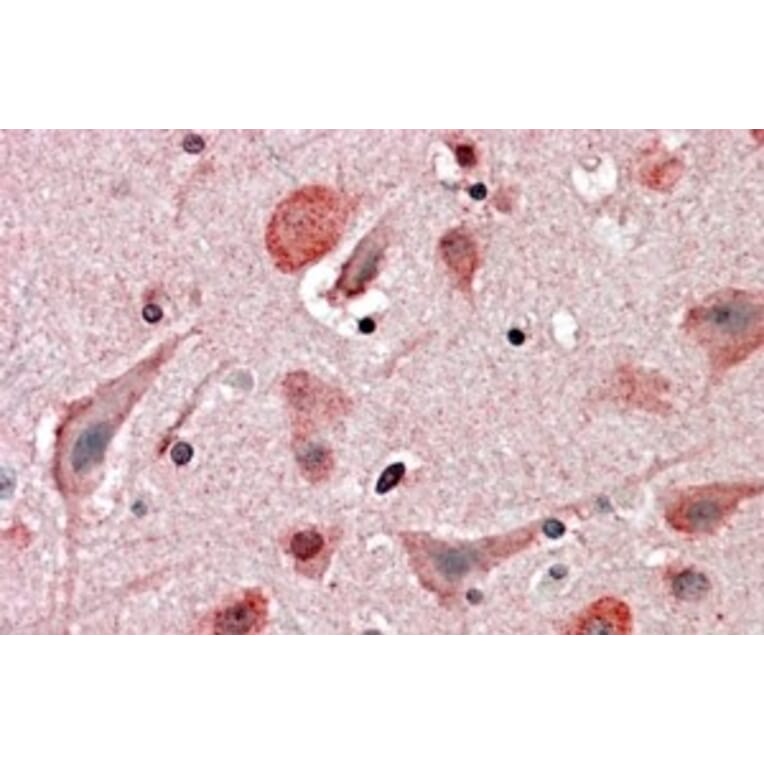 Immunohistochemistry - Anti-HIP2/LIG Antibody (A83244) - Antibodies.com
