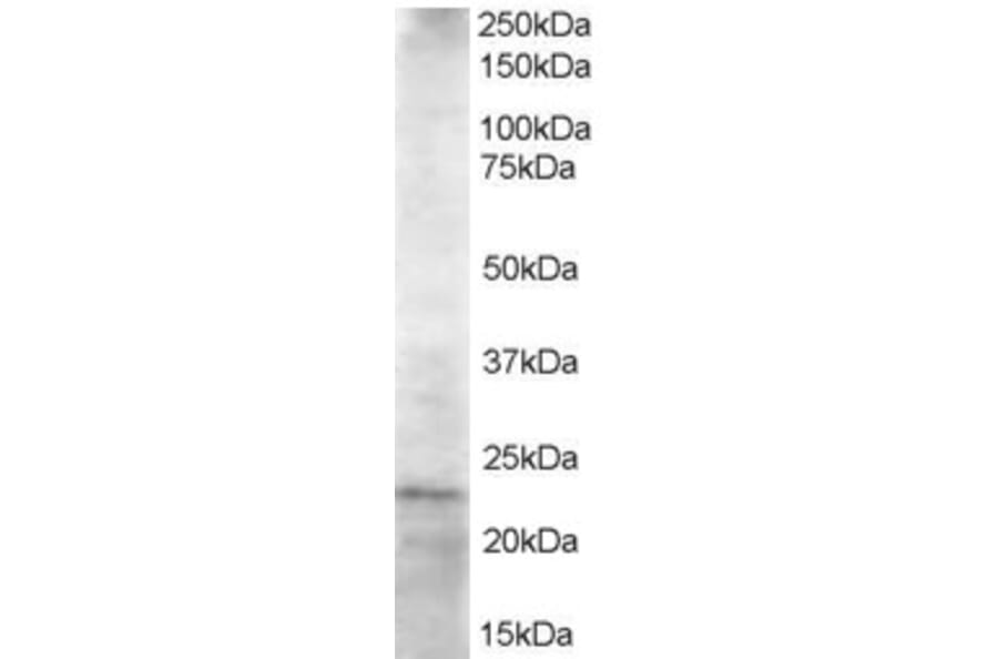 Western Blot - Anti-HIP2/LIG Antibody (A83244) - Antibodies.com