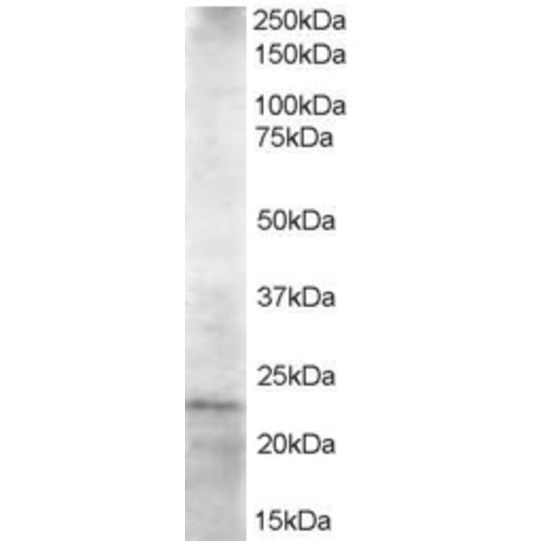 Western Blot - Anti-HIP2/LIG Antibody (A83244) - Antibodies.com