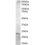 Western Blot - Anti-HIP2/LIG Antibody (A83244) - Antibodies.com