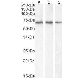 Western Blot - Anti-PCK2 Antibody (A83245) - Antibodies.com