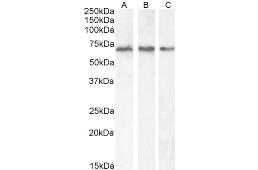 Western Blot - Anti-PCK2 Antibody (A83245) - Antibodies.com