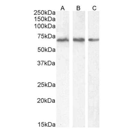 Western Blot - Anti-PCK2 Antibody (A83245) - Antibodies.com