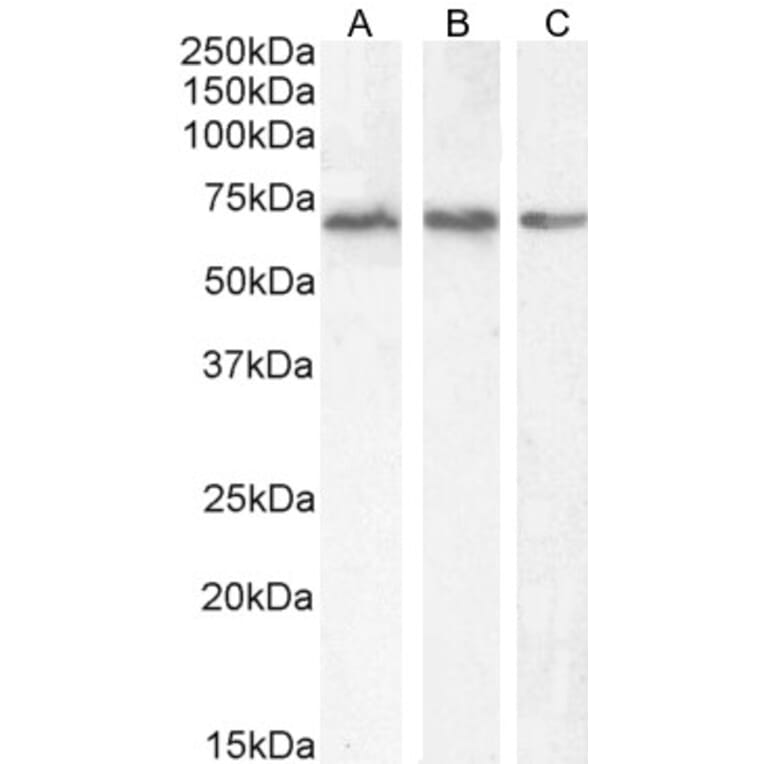 Western Blot - Anti-PCK2 Antibody (A83245) - Antibodies.com