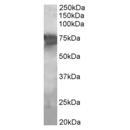 Western Blot - Anti-PCK2 Antibody (A83245) - Antibodies.com