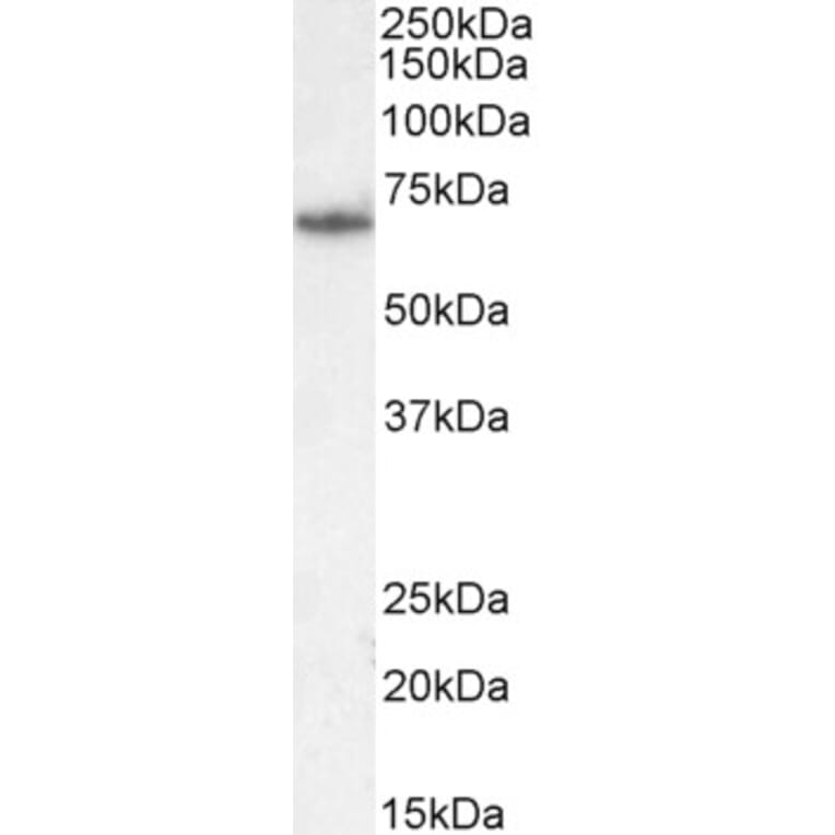 Western Blot - Anti-PCK2 Antibody (A83245) - Antibodies.com
