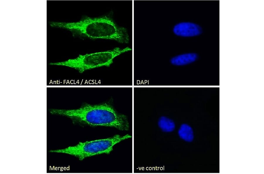 Immunofluorescence - Anti-FACL4 Antibody (A83246) - Antibodies.com