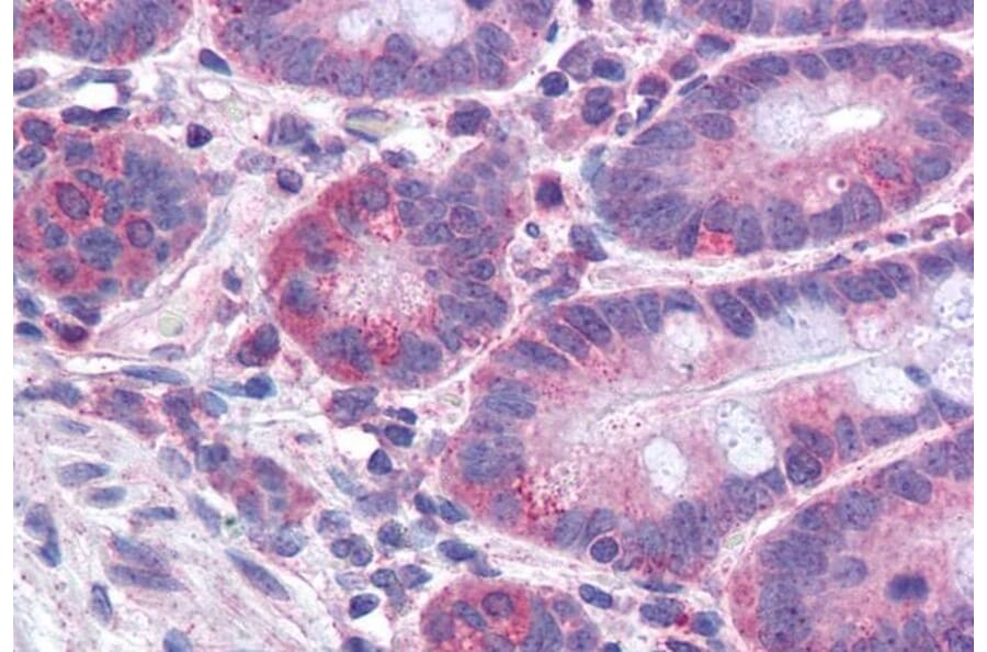 Immunohistochemistry - Anti-FACL4 Antibody (A83246) - Antibodies.com