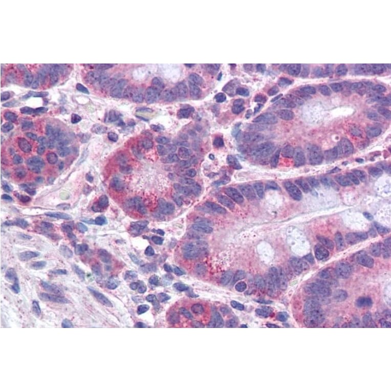 Immunohistochemistry - Anti-FACL4 Antibody (A83246) - Antibodies.com