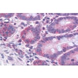 Immunohistochemistry - Anti-FACL4 Antibody (A83246) - Antibodies.com
