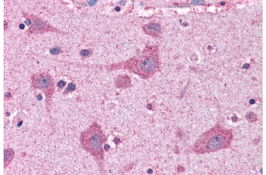 Immunohistochemistry - Anti-FACL4 Antibody (A83246) - Antibodies.com