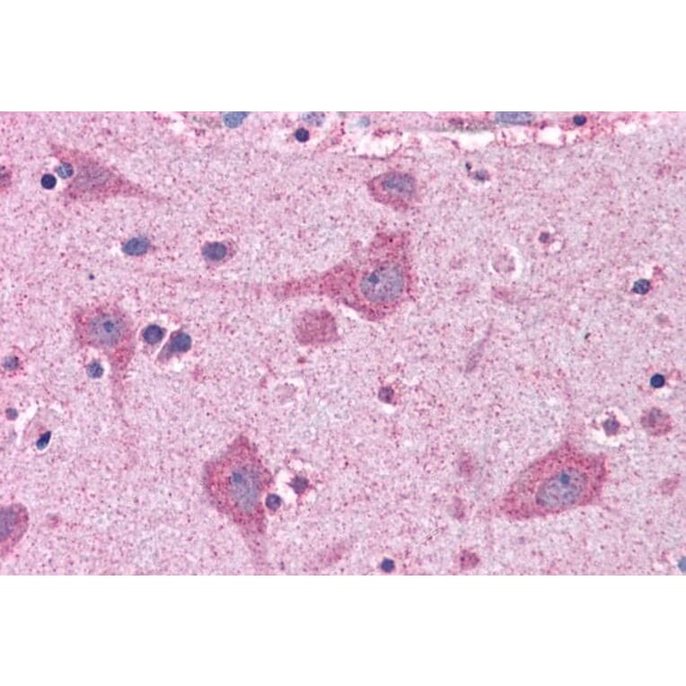 Immunohistochemistry - Anti-FACL4 Antibody (A83246) - Antibodies.com