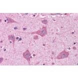 Immunohistochemistry - Anti-FACL4 Antibody (A83246) - Antibodies.com