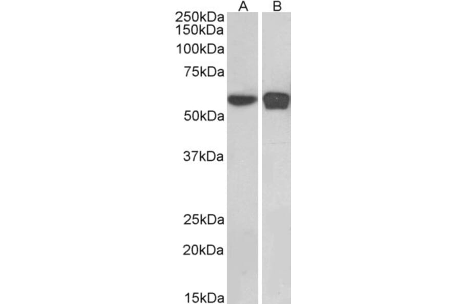 Western Blot - Anti-PLRG1 Antibody (A83247) - Antibodies.com