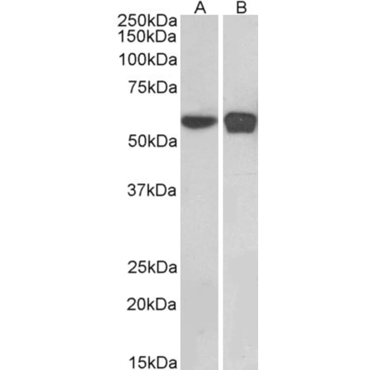 Western Blot - Anti-PLRG1 Antibody (A83247) - Antibodies.com