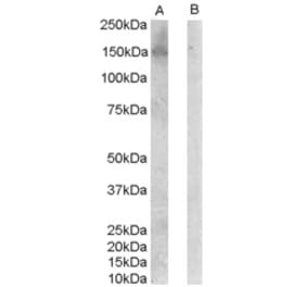 Western Blot - Anti-ERBB3 Antibody (A83248) - Antibodies.com