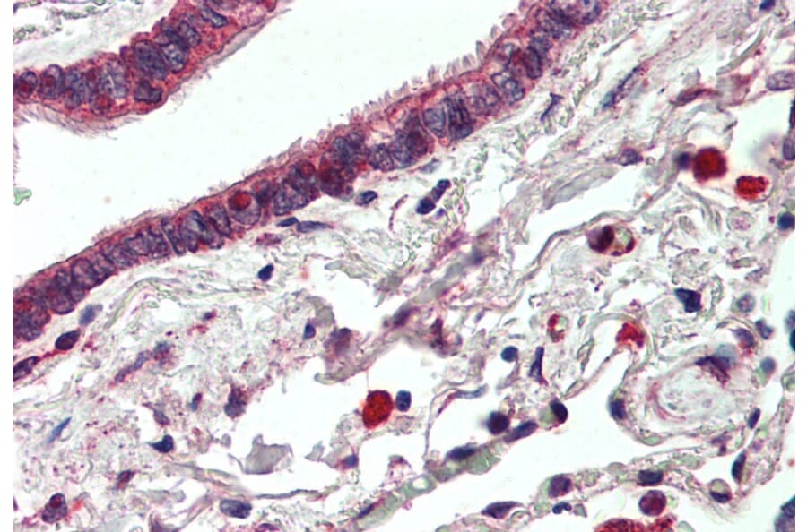Immunohistochemistry - Anti-ErbB3/HER3 Antibody (A83248) - Antibodies.com